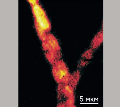 Конфокальное изображение автофлуоресценции в полосе 492-513 нм